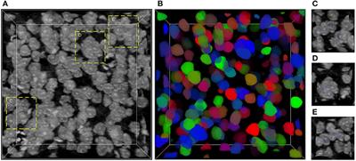 Accurate Neuronal Soma Segmentation Using 3D Multi-Task Learning U-Shaped Fully Convolutional Neural Networks